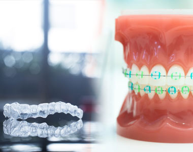 Braces Vs Invisalign- treatment at Martinsville Family Dentistry  