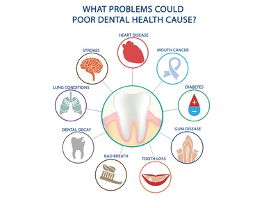 Surprising connection between your Oral and Physical Health- treatment at Martinsville Family Dentistry  