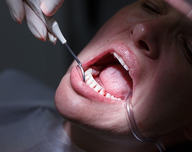 Facts you should know about Gum Disease- treatment at Martinsville Family Dentistry  