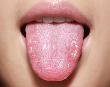 Will cleaning your tongue help reduce the risk of heart disease, arthritis, and other inflammatory diseases?- treatment at Martinsville Family Dentistry  